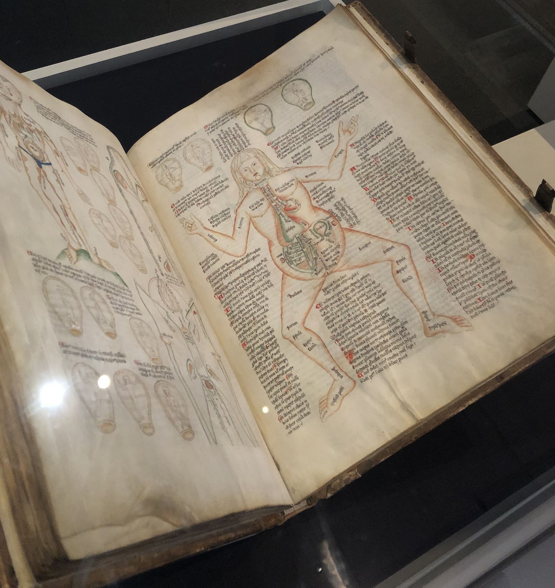 Die älteste erhaltene mittelalterliche Darstellung der Anatomie eines weiblichen Körpers Die älteste erhaltene mittelalterliche Darstellung der Anatomie eines weiblichen Körpers