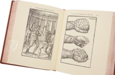 Hieronymus Mercurialis: De Arte Gymnastica – Editions Medicina Rara – Ah VI 1.4 – Universitätsbibliothek Tübingen (Tübingen, Deutschland)