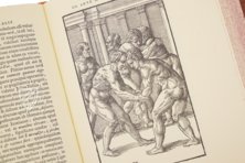 Hieronymus Mercurialis: De Arte Gymnastica – Editions Medicina Rara – Ah VI 1.4 – Universitätsbibliothek Tübingen (Tübingen, Deutschland)