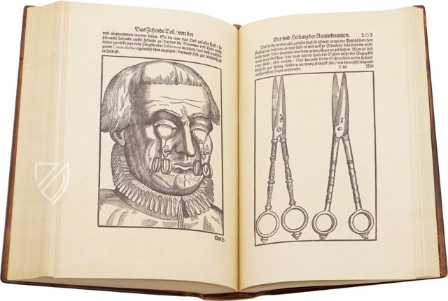 Ophthalmodouleia - Augendienst – Editions Medicina Rara – 38.1.1 Phys. 2° – Herzog August Bibliothek (Wolfenbüttel, Deutschland)